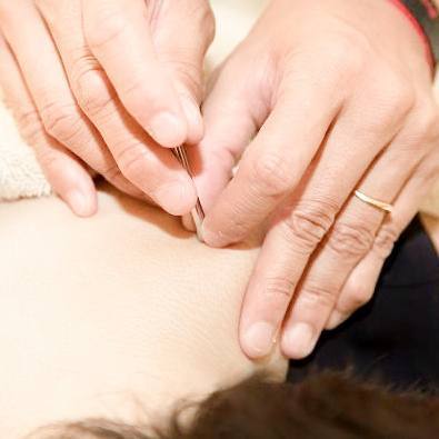 保険鍼灸イメージ